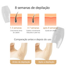 Depilador a Laser - Skin Soft mais 1 Óculos de Proteção